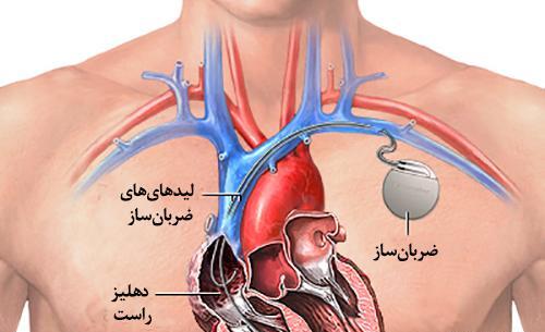 عکس خون ضربان