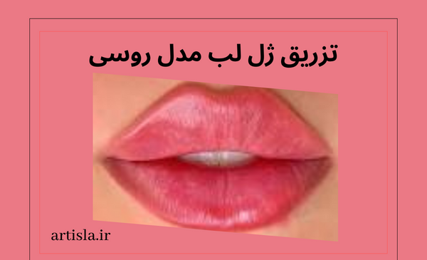 عکس قیمت تزریق ژل لب مدل روسی نی نی سایت