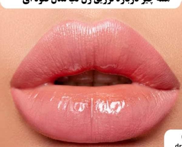 عکس قیمت تزریق ژل لب مدل روسی نی نی سایت