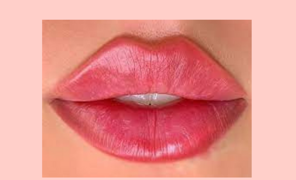 عکس قیمت تزریق ژل لب مدل روسی نی نی سایت