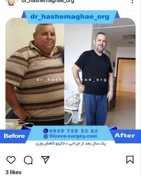 عکس کاهش وزن نی نی سایت