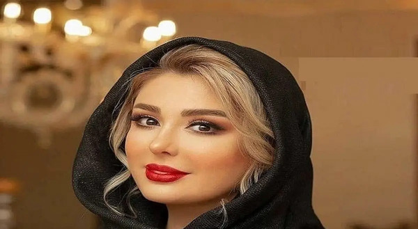 عکس قبل جراحی نیوشا ضیغمی