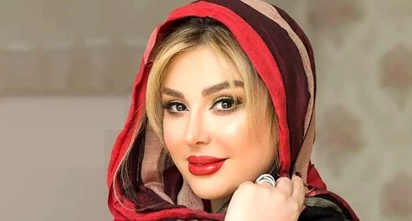 عکس قبل جراحی نیوشا ضیغمی