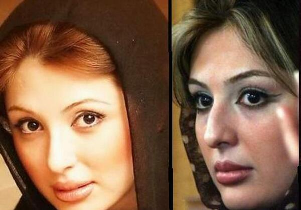 عکس قبل جراحی نیوشا ضیغمی