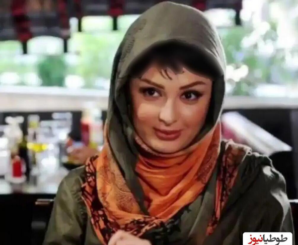 عکس قبل جراحی نیوشا ضیغمی