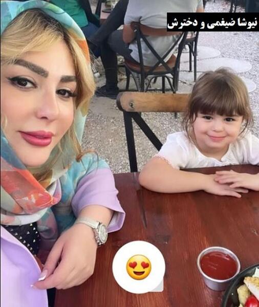 عکس قبل جراحی نیوشا ضیغمی