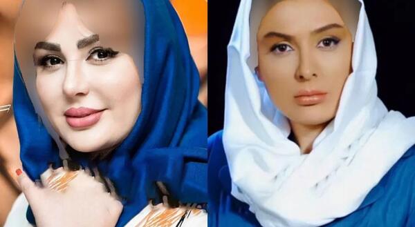 عکس قبل جراحی نیوشا ضیغمی