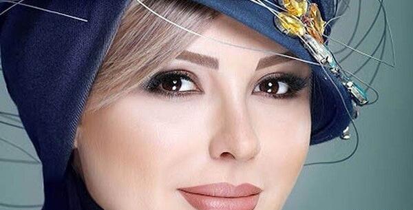 عکس قبل جراحی نیوشا ضیغمی