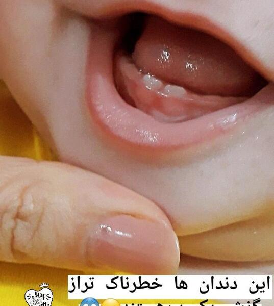 عکس نوشته اولین دندونت مبارک