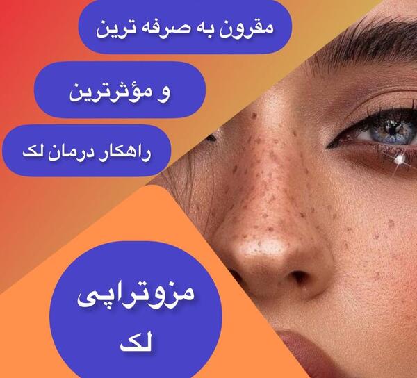 لک صورت عکس نی نی سایت