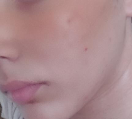 لک صورت عکس نی نی سایت