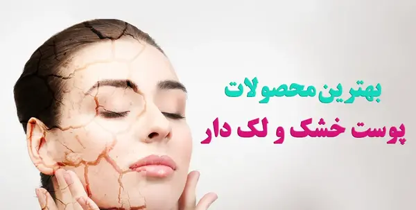 لک صورت عکس نی نی سایت