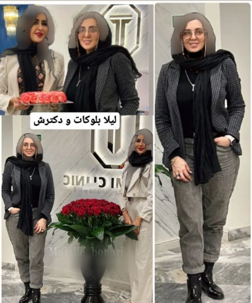عکسهای لیلا بلوکات قبل از عمل بینی