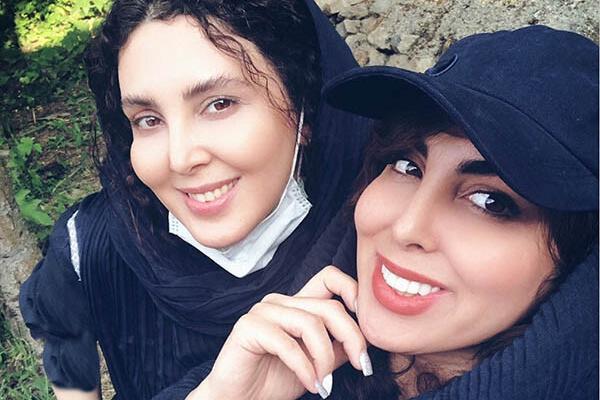 عکسهای لیلا بلوکات قبل از عمل بینی