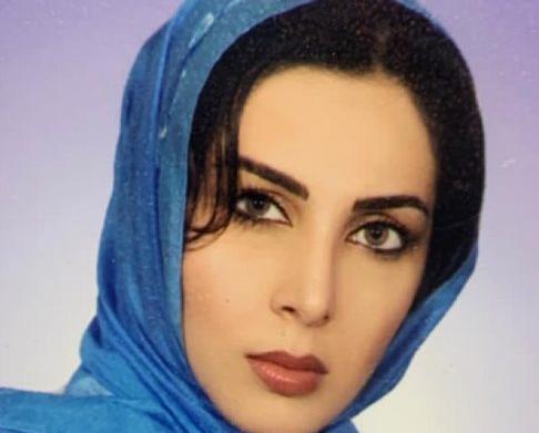 عکسهای لیلا بلوکات قبل از عمل بینی
