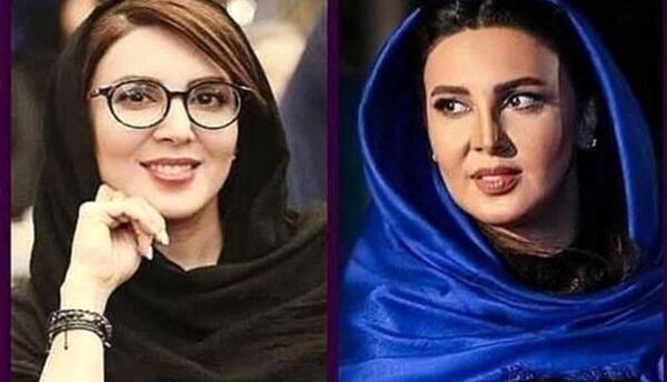 عکسهای لیلا بلوکات قبل از عمل بینی