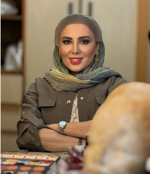 عکسهای لیلا بلوکات قبل از عمل بینی