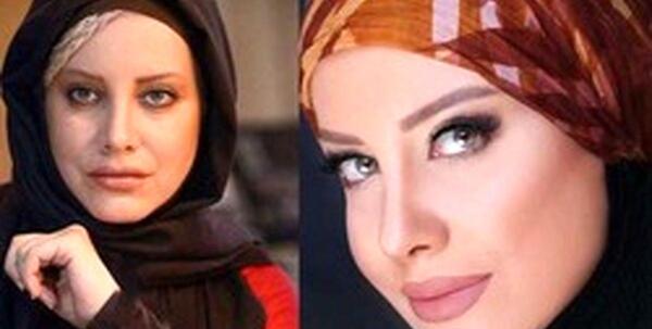 عکسهای لیلا بلوکات قبل از عمل بینی