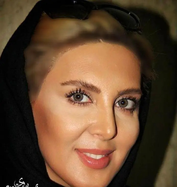 عکسهای لیلا بلوکات قبل از عمل بینی