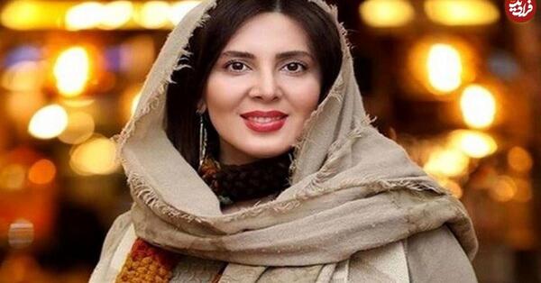 عکسهای لیلا بلوکات قبل از عمل بینی