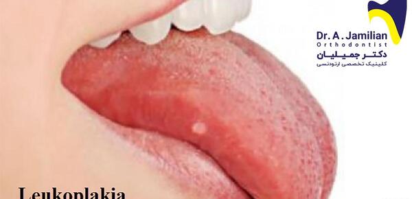 عکس آقای لب و دهان