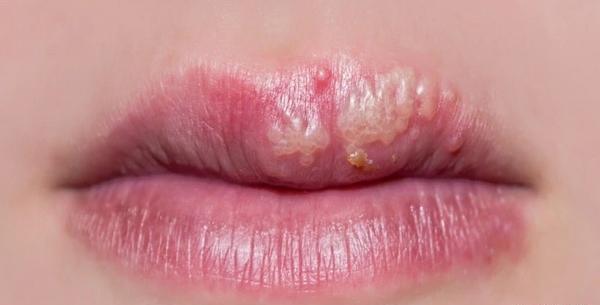 عکس آقای لب و دهان