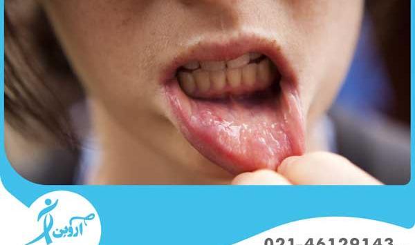 عکس آقای لب و دهان