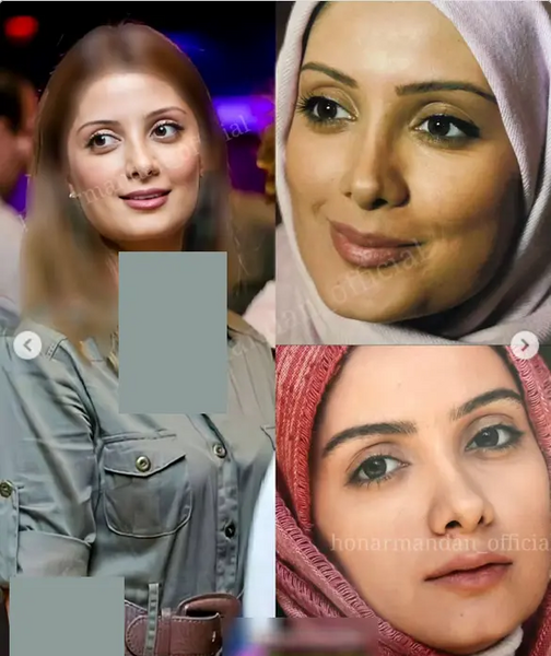 عکس سمیرا سیاح قبل از عمل بینی