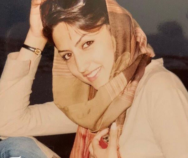 عکس سمیرا سیاح قبل از عمل بینی