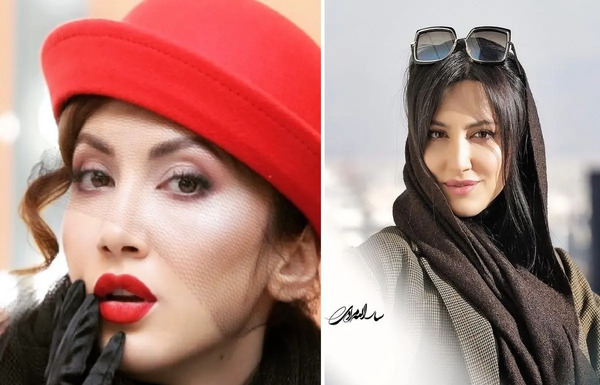 عکس سمیرا سیاح قبل از عمل بینی