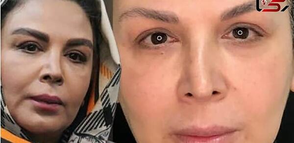 عکس شهره سلطانی در جوانی