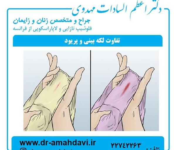 عکس لکه بینی در حاملگی