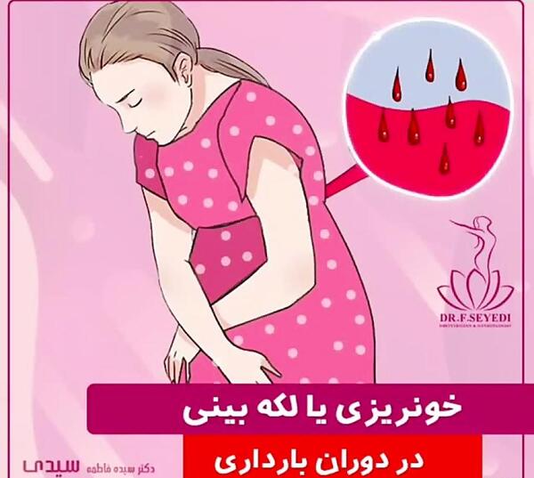 عکس لکه بینی در حاملگی