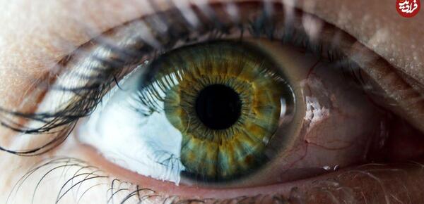 عکس چشم هفت رنگ