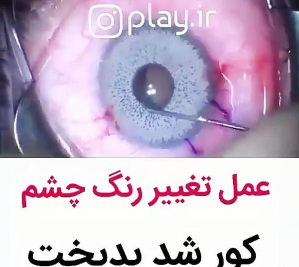 عکس چشم هفت رنگ