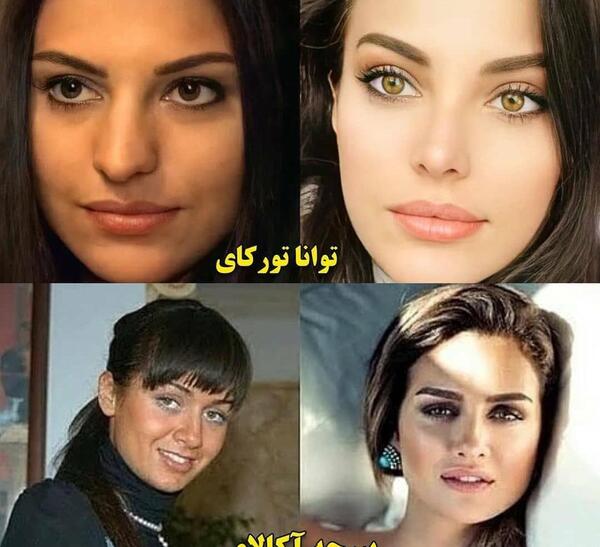 عکس های هانده ارچل قبل از عمل زیبایی