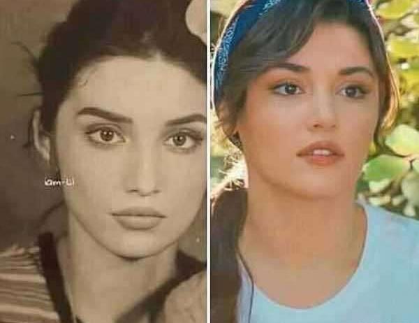 عکس های هانده ارچل قبل از عمل زیبایی