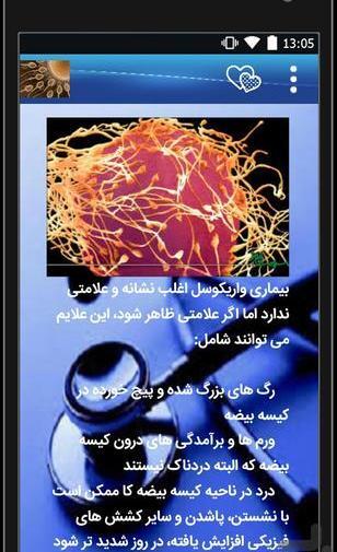 عکسی از واریکوسل