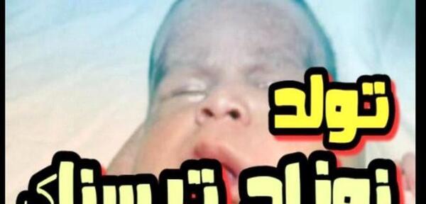 عکس نوزاد وحشتناک