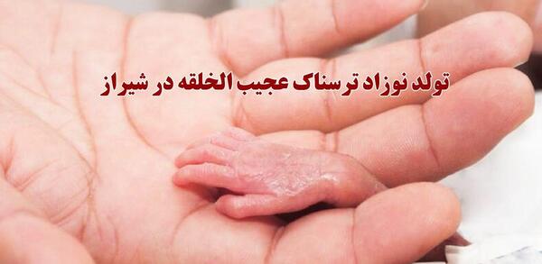 عکس نوزاد وحشتناک