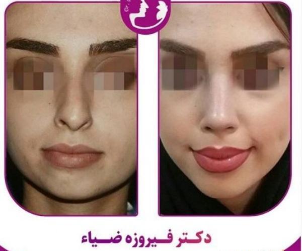 عکس دکتر فیروزه ضیا
