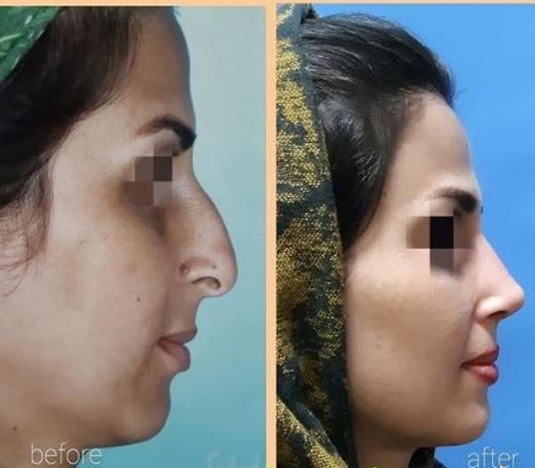 عکس دکتر فیروزه ضیا