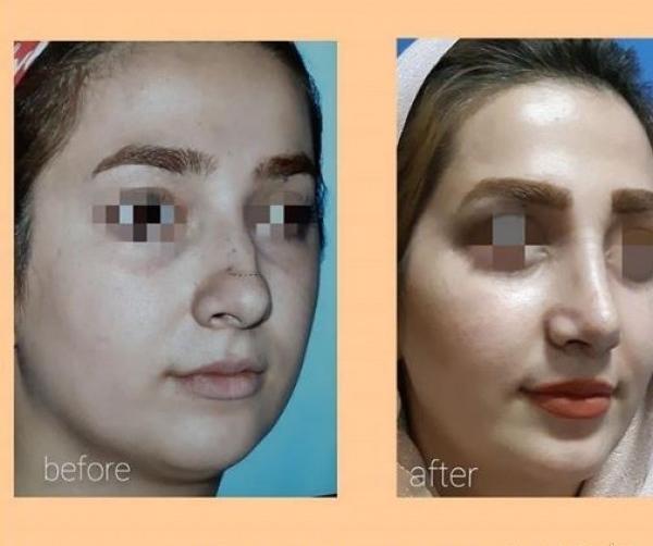 عکس دکتر فیروزه ضیا