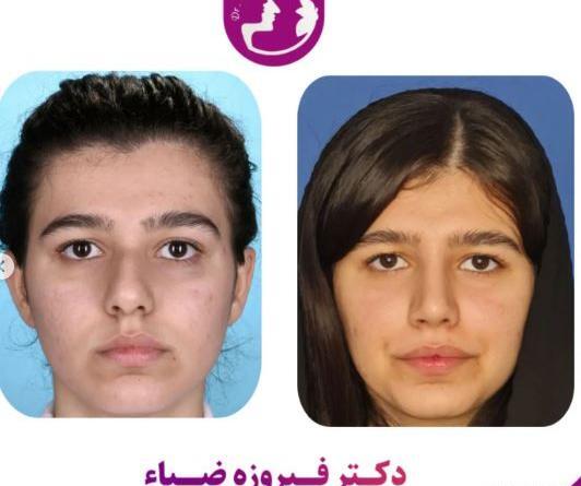 عکس دکتر فیروزه ضیا