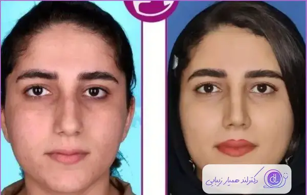 عکس دکتر فیروزه ضیا