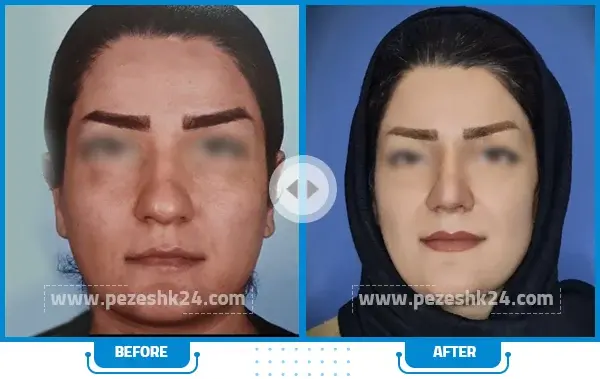 عکس دکتر فیروزه ضیا
