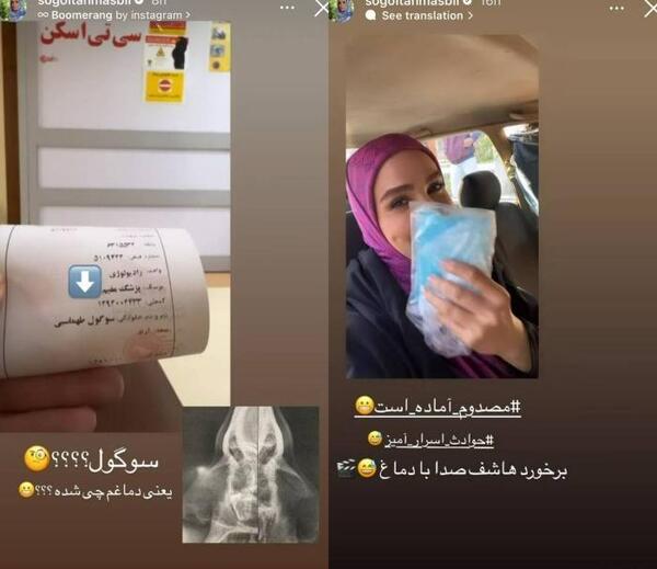 عکس حامد طهماسبی قبل از عمل
