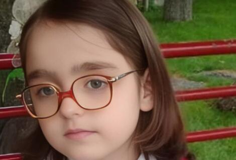 عکس چهره مومو