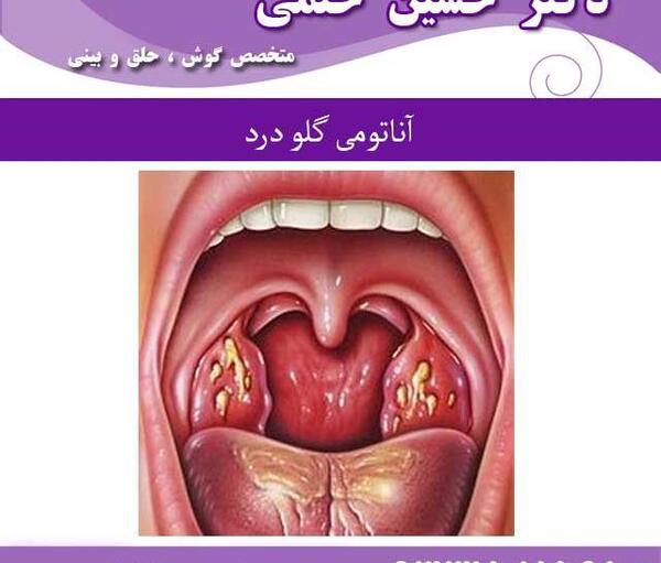 عکس قرمز شدن گلو