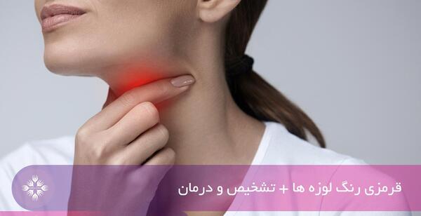 عکس قرمز شدن گلو